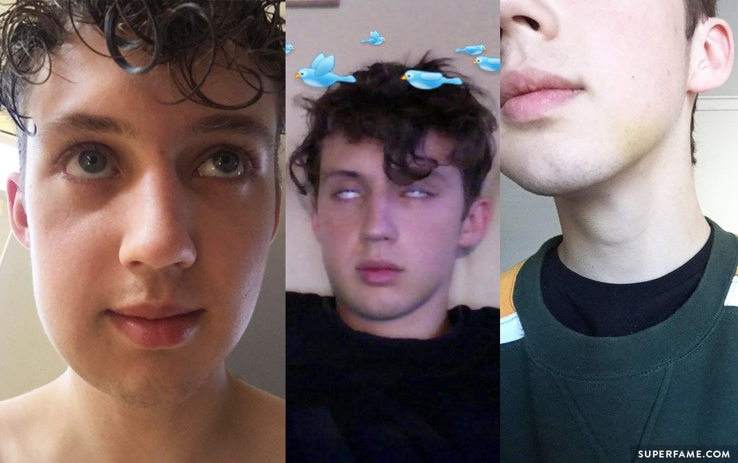 Troye Sivan's stages of swelling.