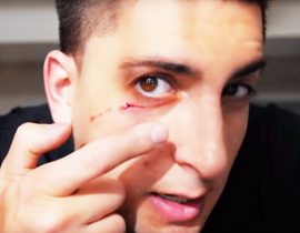 Jesse Wellens injured.