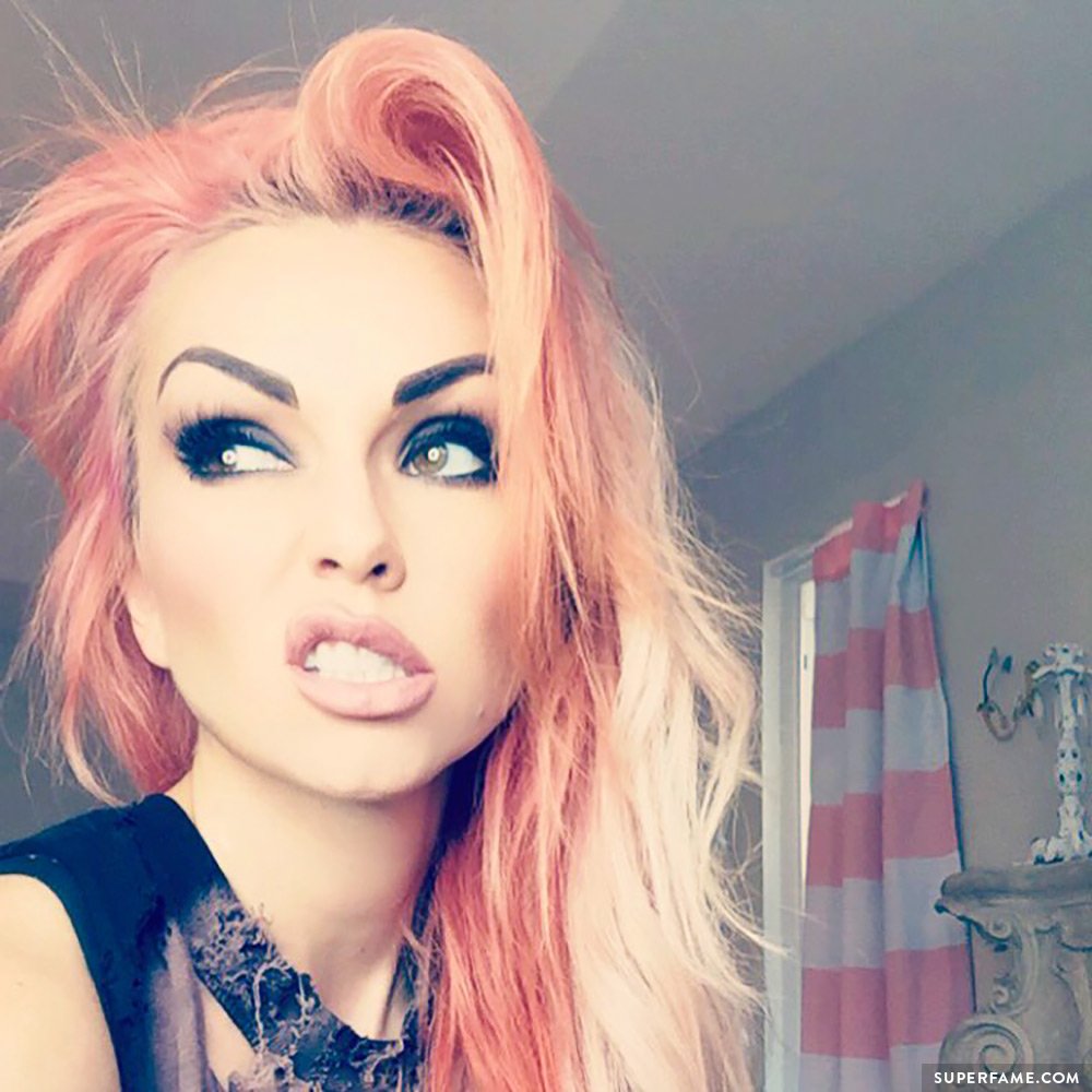 Kandee Johnson Has Emergency Allergic Reaction, Gets Shots at VidCon ...