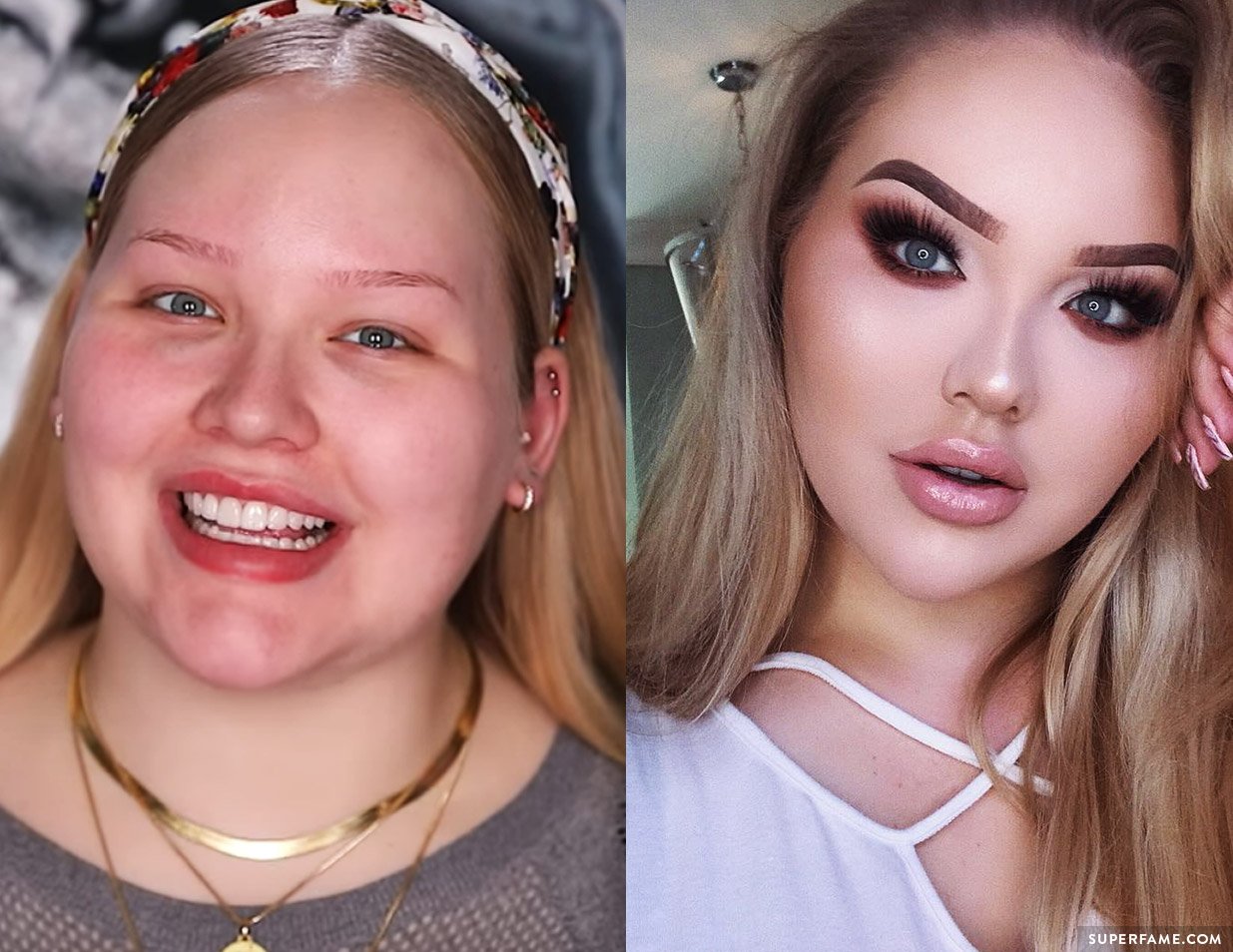 Макияж пластика фото. Никки туториал. NIKKIETUTORIALS В детстве. NIKKIETUTORIALS до пластики. NIKKIETUTORIALS без макияжа.