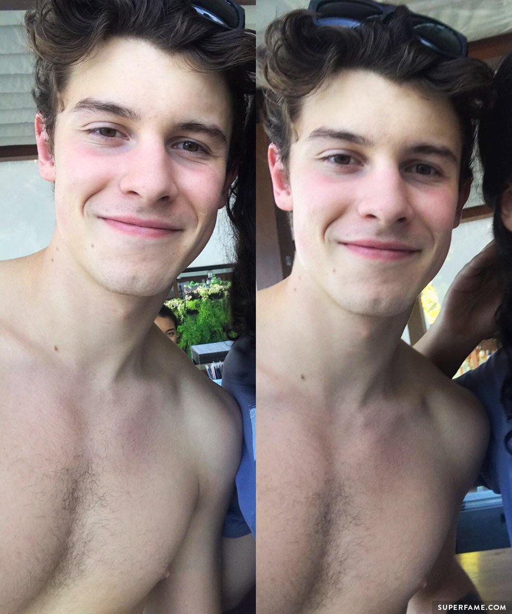 Shawn's chest hair.